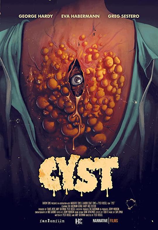 囊肿 CYST (2020) 1080p 原盘Remux 中文字幕 已刮削
